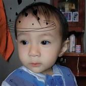 xì 