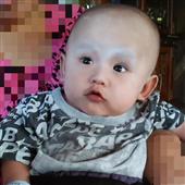 Kết
