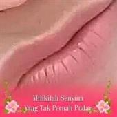 Kết